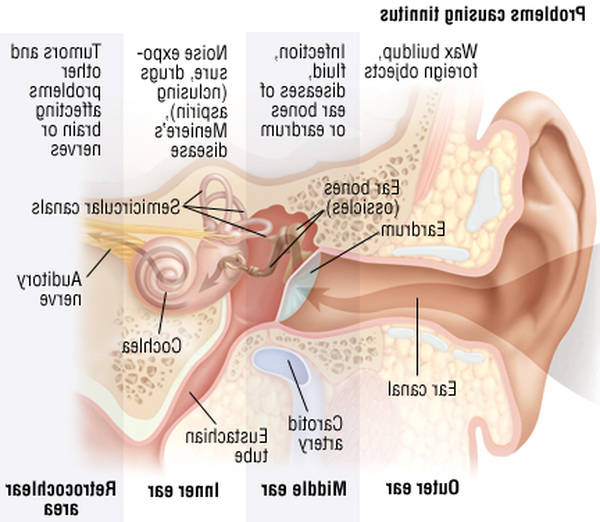 mild tinnitus causes